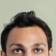 However, wet hair is more fragile than dry hair so it could contribute to breakage, which affects the hair shaft. Can Wearing Hats Cause Hair Loss Skalp Hair Loss Blog