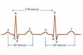 Image result for QT Interval
