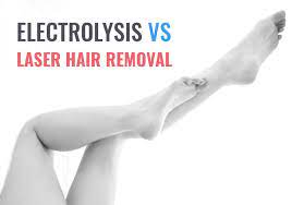 When it comes to removing hair permanently, you have two options Electrolysis Vs Laser Hair Removal Costs