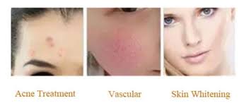 When the hair follicle is only damaged, the hair will eventually regrow. Professional Ipl Shr Opt Laser Permanent Hair Removal Beauty Machine China Ipl Hair Removal Laser Hair Removal Machine Made In China Com