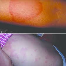 Image result for Wheal