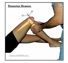 Image result for PCL Sulcus Test