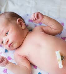 How should i bathe my newborn baby while caring for the umbilical cord? 6 Tips To Take Care Of Your Baby S Umbilical Cord