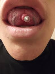 You can usually treat an infected tongue piercing at home. Is There Something Wrong With My Tongue Piercing Possibly Infected Got It Mid February 2018 Piercing