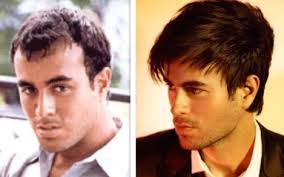 Enrique miguel iglesias preysler (spanish pronunciation: Which Celebrities Have Had Hair Transplants Or Wear Wigs