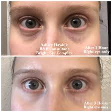 Rodan & Fields Independent Consultant