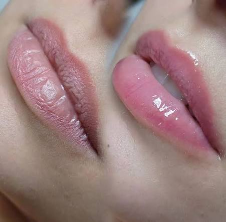 Hidragloss