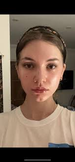 My absolutely insane progress : r/GuaSha