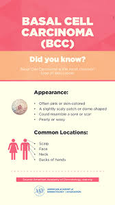 Pin On Health Related