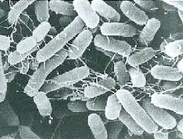 Salmonella bacteria typically live in animal and human intestines and are shed through feces. Salmonella Enteritidis Food Hygiene Help Desk Bureau Of Social Welfare And Public Health Tokyo Metropolitan Government