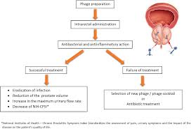 Image result for Acute Bacterial Prostatitis