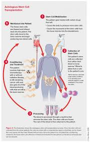 The goal of a stem cell transplant in cancer is to prolong life and, in many cases, even cure the cancer. Autologous Stem Cell Transplantation Leukemia And Lymphoma Society