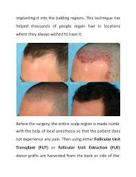Lack or loss of strength. Side Effects Of Hair Regrowth Products