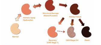 Treatment of kidney disease focuses on slowing the progression of kidney damage by controlling the underlying causes. Kidney Disease Elwood Vet