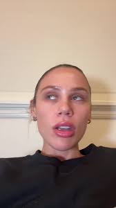 Hallie Batchelder Before and After Teeth