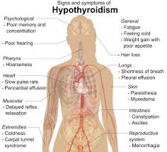 I Am A Hypothyroid Fighter For Those Of You Who Don T Know What Hypothyroidism Is Lemme Hypothyroidism Symptoms Hypothyroidism Treatment Thyroid Treatment