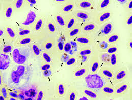 Aviaria, in russia primi casi nell'uomo: 2 Diagnostico De Malaria Aviaria Em Bobo Pequeno Puffinus Puffinus Download Scientific Diagram