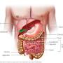 crohn's and colitis from www.mayoclinic.org