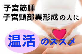 医師解説 子宮筋腫や子宮頸部異形成 などの婦人病は骨盤内の冷えも重大原因 体を温める 温活 で防ごう カラダネ 子宮頸部 健康になる 健康と美容
