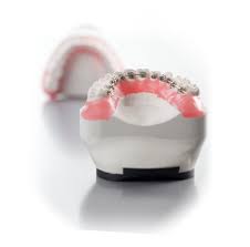 But, the braces do begin to work right away, so you may notice that your teeth and gums feel a bit sore. How Long Do Lingual Braces Take Birchgrove Dental