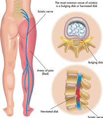 Take frequent walking breaks and try alternating between your. Pregnancy Care