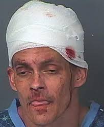 Police K9 named Justice bites suspected meth dealer in head following  botched drug deal in Florida