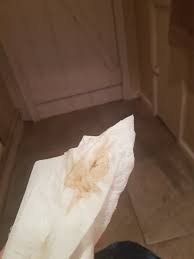 We did not find results for: Tmi Does This Look Like Implantation Bleeding To You