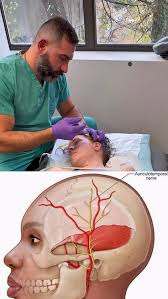 Image result for Ear Nerve Block