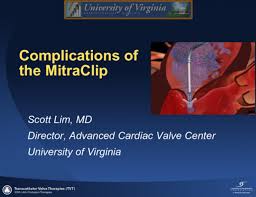 Potential Complications Of The Mitraclip Procedure Tctmd Com