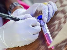 Covid cases based on this test soared nationwide while, at the same time, hospitalizations and deaths from the flu dropped to near zero. Rt Pcr Test Cost Covid 19 How Much Does Rt Pcr Test Cost Find State Wise Price Here India News