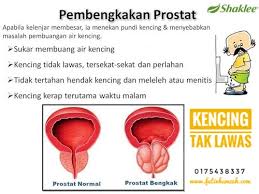I had a client who had his underwear all stained with urine. Atasi Masalah Kencing Kotor Vitaminsoho Com