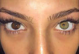 Growing Up I Hated Having Two Different Coloured Eyes I Didn T Want To Be Different Every Si Different Colored Eyes Aesthetic Eyes Two Different Colored Eyes