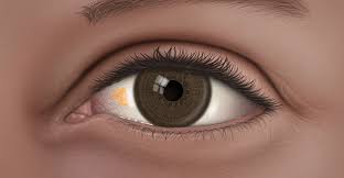 You can also move your eyes sideways if rotating them doesn't work. What Is A Pinguecula And A Pterygium Surfer S Eye American Academy Of Ophthalmology