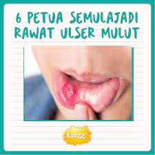 Ya, ia adalah perkara yang normal namun boleh dielakkan. Nak Tahu Tak Cara Hilangkan Ulser Lazz Susu Kambing Facebook