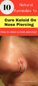 Crush three to four aspirin tablets. Pin On Natural Cures