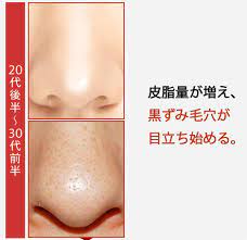 ファンデーションでは隠れない頬の毛穴に サイエンスコスメで頬毛穴顔が なめらか美肌に 毛穴ケア プログラム ビーグレン ビーグレン 毛穴 ビーグレン 裏技ビューティー