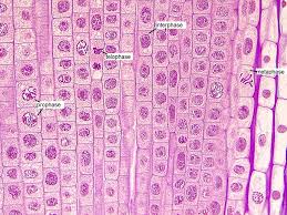 We did not find results for: Second Onion Root Tip View With Stages Of Mitosis Labeled Flickr