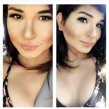 ELECTROLYSIS BY LISA