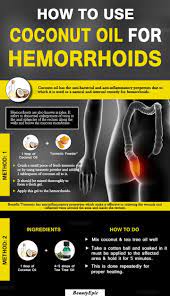 How To Use Coconut Oil For Hemorrhoids Skintreatment Coconut Oil For Hemorrhoids Home Remedies For Hemorrhoids Hemorrhoid Remedies