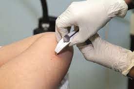 Both the pill and the rod could cause: Contraceptive Implant Linked To Repeat Abortion The Pharmaceutical Journal