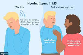 Tinnitus may be described as buzzing, ringing, roaring, whistling, or hissing and is sometimes variable and complex. Hearing Problems And Multiple Sclerosis