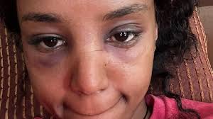 Petition · Call To International Intervention: Justice for Keneni Adugna