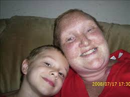 Angela Bretzlaff Obituary (2008)