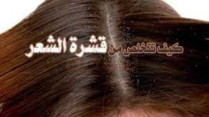 أناقة مغربية وصفة فعالة للقضاء على القشرة و الحكة و تساقط الشعر عن تجربتي الشخصية beauty hair beauty hair accessories