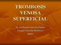 Venous thromboembolism and superficial vein thrombosis account for about 90% of venous thrombosis. Ppt Trombosis Venosa Superficial Powerpoint Presentation Free Download Id 5733141