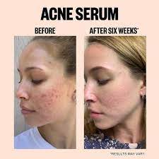Pin On Skin Care