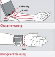 Andererseits kann die ursache auch völlig harmlos sein: 1 X 1 Der Blutdruckmessung