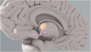 Image result for Thalamic Stimulation