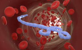 These are marked by severe bleeding (hemorrhage), organ failure and, in many cases, death. In Light Of Ebola Outbreak Who Issues Food Safety Reminders Food Safety News