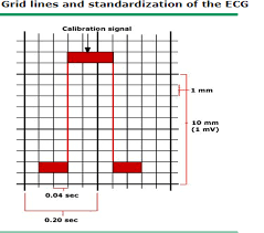 Check spelling or type a new query. Elektrokardiografi Pendekatan Dasar Analisis Klinis Whitecoathunter